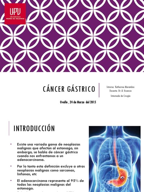 04 Cancer Gastrico | Metástasis | Cáncer