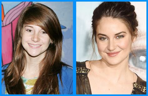 10 celebridades que se volvieron atractivas con la pubertad