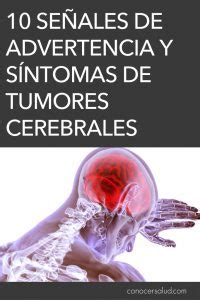 10 señales de advertencia y síntomas de tumores cerebrales que debe ...