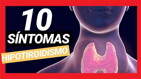 10 SIGNOS Y SÍNTOMAS DE HIPOTIROIDISMO | GLÁNDULA TIROIDES ...