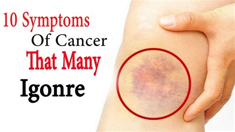 10 symptoms of cancer that many ignore | Sign and symptoms ...
