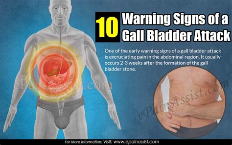 10 Warning Signs of a Gall Bladder Attack