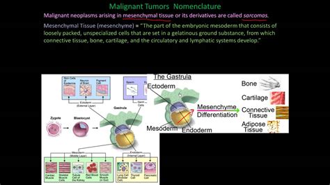 112P   Nomenclature of benign and malignant cancers, How ...