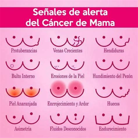 #121 #SumateAlRosa: DM Contra el Cáncer de Mama | Salud en ...