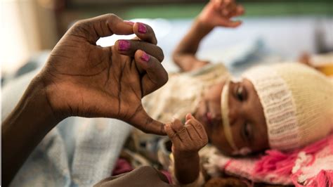 15 impresionantes fotos del año de Médicos Sin Fronteras