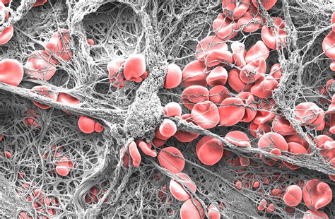 1st Prize for Microscopic Image of Blood Clot   Microscopy