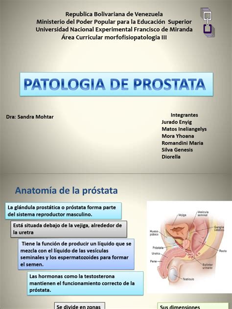 2 Patologias de La Prostata | Cancer de prostata | Antígeno específico ...