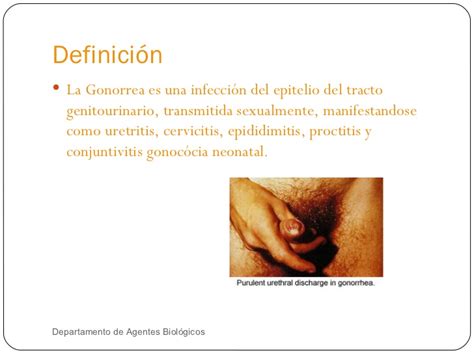 24. Neisseria gonorrhoeae