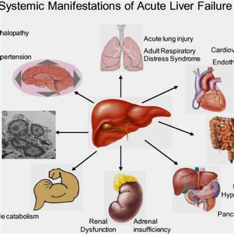 27 best images about Stages Of Liver Damage on Pinterest ...