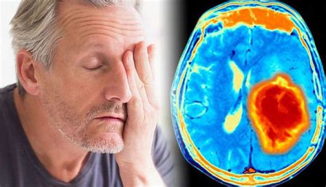 3 Major Causes and Symptoms of Brain Tumor   lifeberrys.com