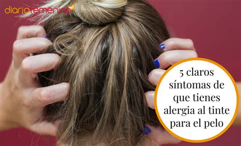 4 claros síntomas de que tienes alergia al tinte para el pelo