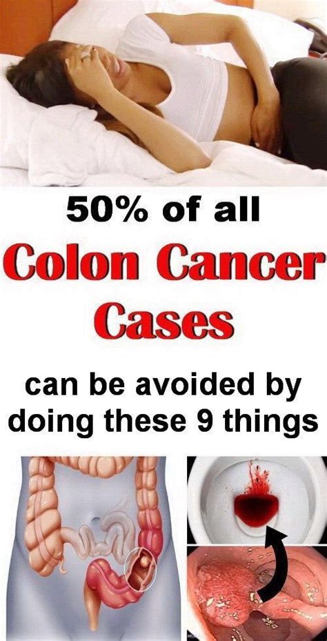 4 Colon Cancer Signs and Symptoms That Are Often Ignored ...