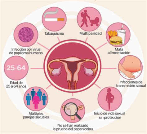 4 cosas que debes saber sobre el cáncer cérvico uterino ...