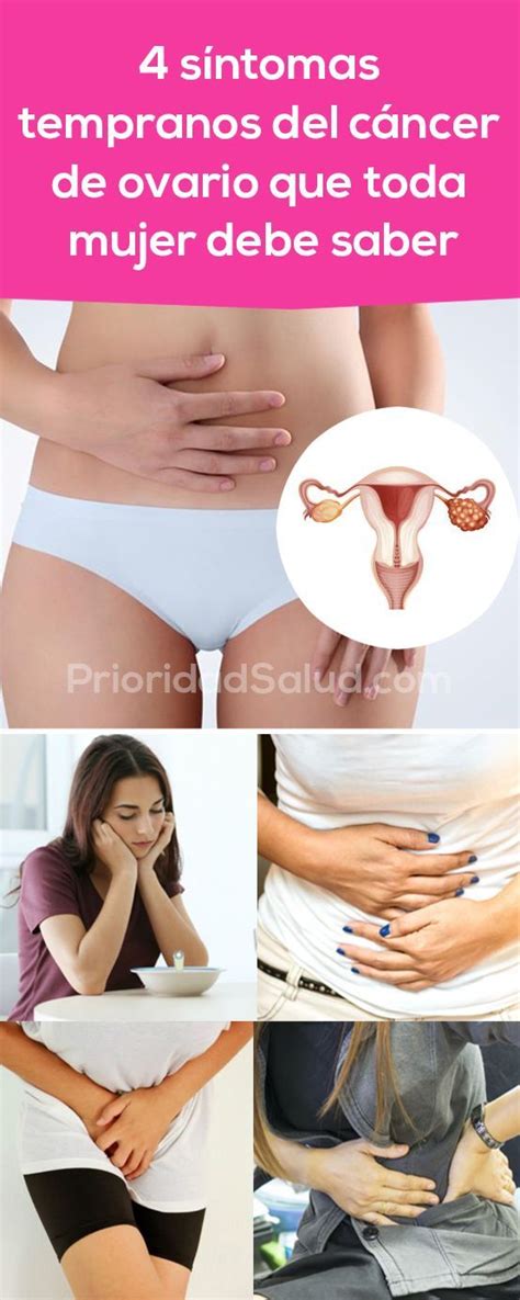 4 síntomas tempranos del cáncer de ovario que debes ...