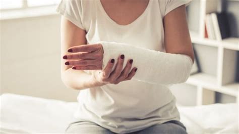 5 mitos comunes sobre fracturas de huesos y por qué no son ...
