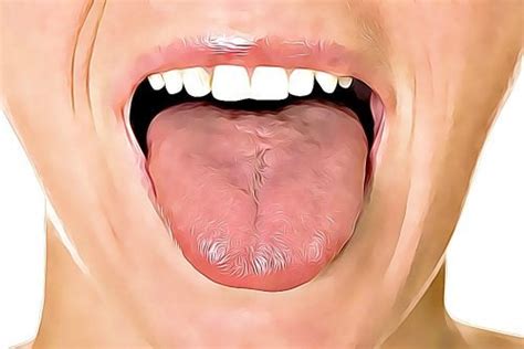 6 remedios caseros para curar las llagas en la lengua ...