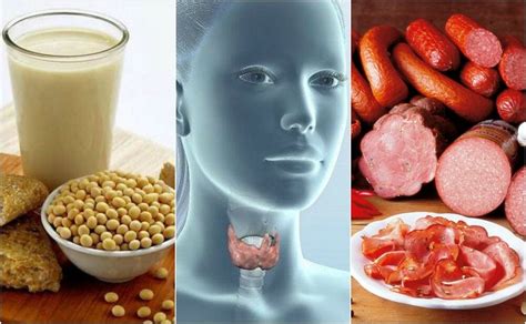 7 alimentos prohibidos si sufres hipotiroidismo — Mejor ...