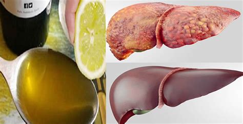 7 beneficios de la receta de cómo desintoxicar el hígado naturalmente