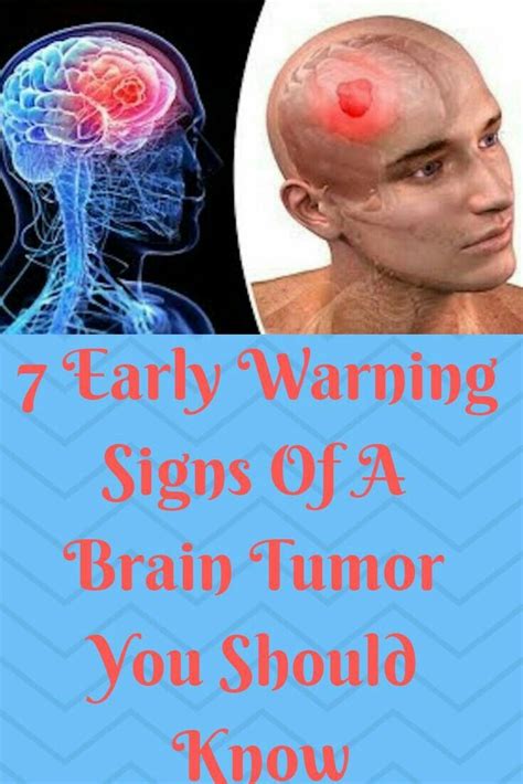 7 Early warning signs of 1 BRAIN TUMOR you should know ...