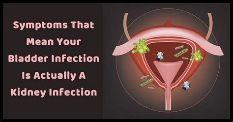 7 Important Symptoms That Mean Your Bladder Infection Is ...