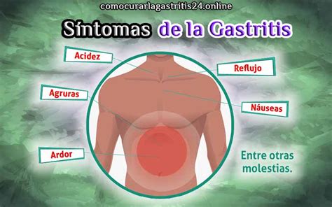 7 Síntomas de la Gastritis【30 de septiembre 】【2022】