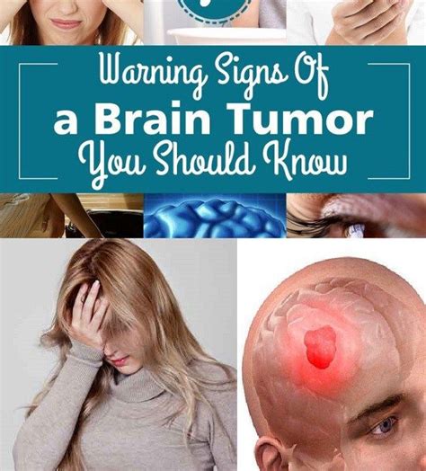 7 Warning Signs Of A Brain Tumor You Should Know | Brain ...