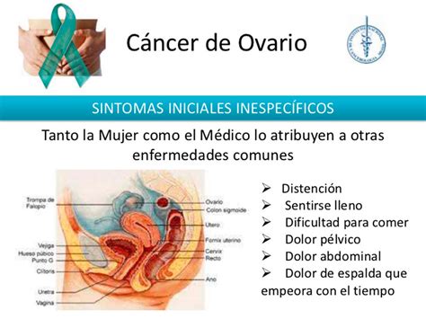 70% de casos de cáncer de ovario se diagnostican en etapas ...