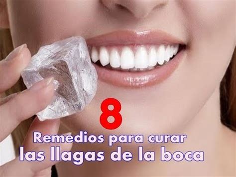 8 Remedios para curar las llagas de la boca   YouTube