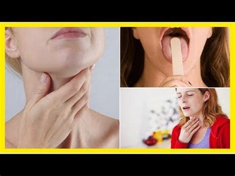 8 sintomas iniciais de câncer de garganta que não devemos ...