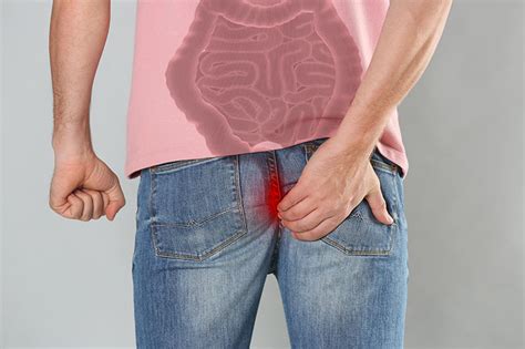 8 Ulcerative Colitis Symptoms That Should Be on Your Radar ...