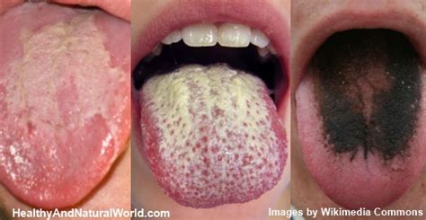 8 Warning Signs Your Tongue May Be Sending About Your Health
