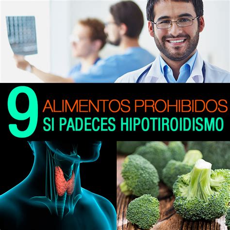 9 Alimentos Prohibidos Si Padeces Hipotiroidismo   La Guía ...