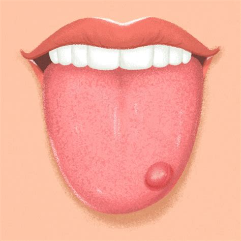 9 Things Your Tongue Is Trying to Tell You About Your Health