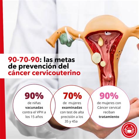 90 70 90: las metas de prevención del cáncer cervicouterino   Sociedad ...