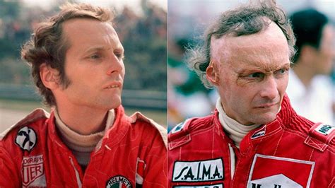 A 45 años del accidente de Niki Lauda en Nürburgring que marcó para ...