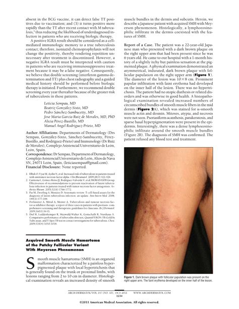 Acquired Smooth Muscle Hamartoma of the Patchy Follicular Variant With ...