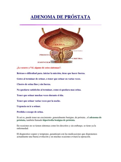 ADENOMA DE PRÓSTATA | Cancer de prostata | Vejiga urinaria