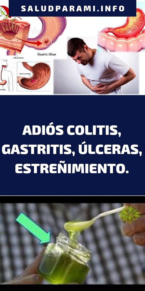 ADIÓS COLITIS, GASTRITIS, ÚLCERAS, ESTREÑIMIENTO.   Salud para Mi ...