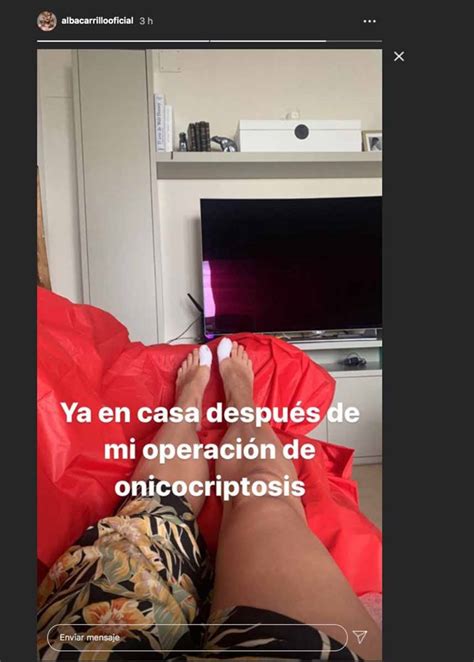 Alba Carrillo se recupera de su operación en los pies