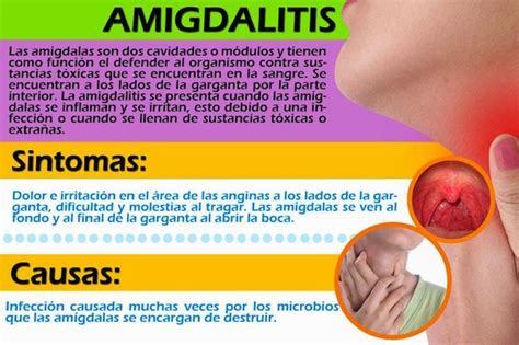 Alimentos para combatir la amigdalitis | Blog de farmacia