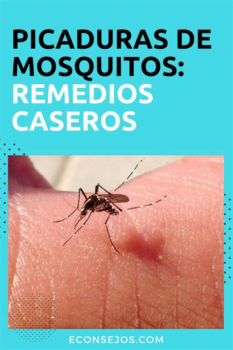 Alivia las picaduras de mosquitos con estos remedios ...
