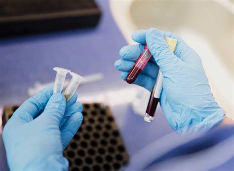 Análisis de sangre detecta con precisión 50 tipos de ...