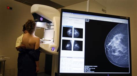 Anatomía del cáncer de mama: diagnóstico, abordaje y ...
