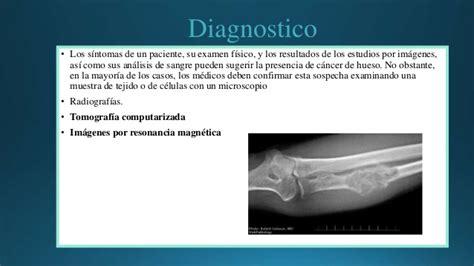 Anatomia enfermedades de los Huesos