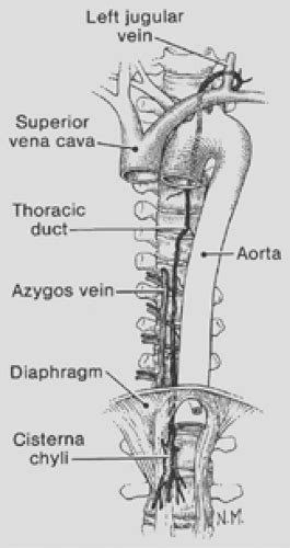 Anatomy of the Thoracic Duct and Chylothorax | Thoracic Key