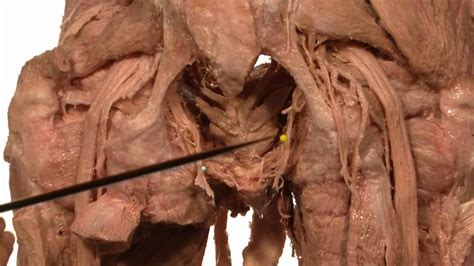 Anatomy Series, Male Urethra, Vas Deferens and Ejaculatory ...