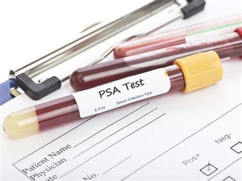 Antígeno Prostático Específico  PSA  | RH + | Laboratorio ...
