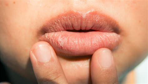 Aparência dos lábios pode indicar anemia, doença hepática ...