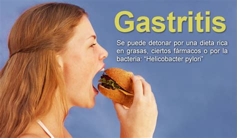 Aprende Que Alimentos Son Buenos para La Gastritis y que Alimentos Son ...