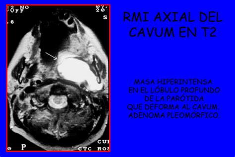 Apunte: CUELLO PATOLOGICO   DEFENSA | Injuria y Defensa | Medicina ...